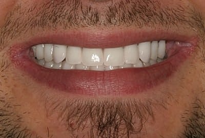 Close-up of a smiling mouth and teeth.