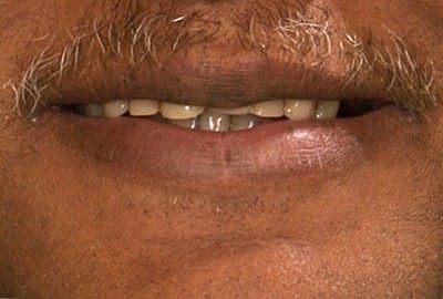 Close-up of a mouth with mustache.