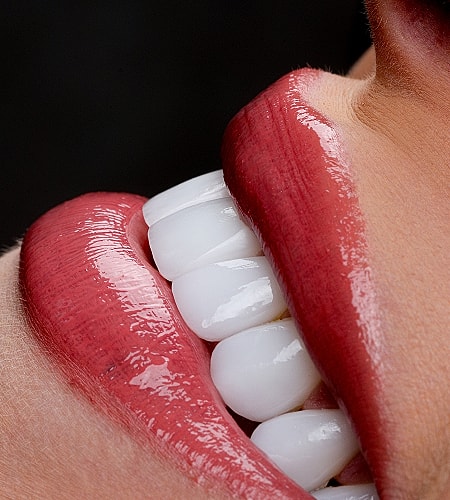 Close-up of glossy lips and white teeth.
