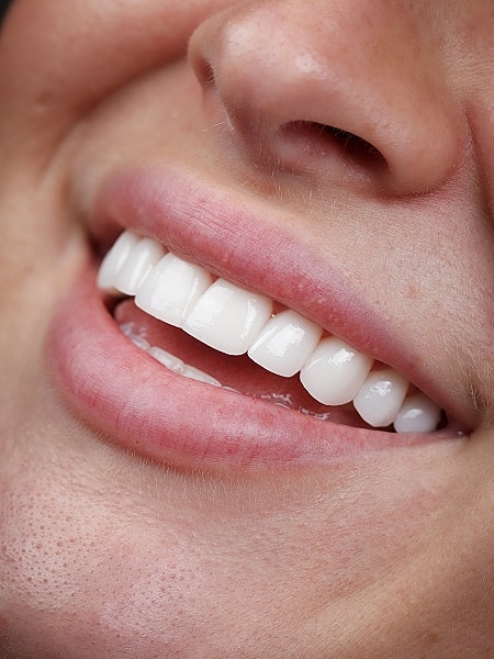 Close-up of a smiling mouth with white teeth.