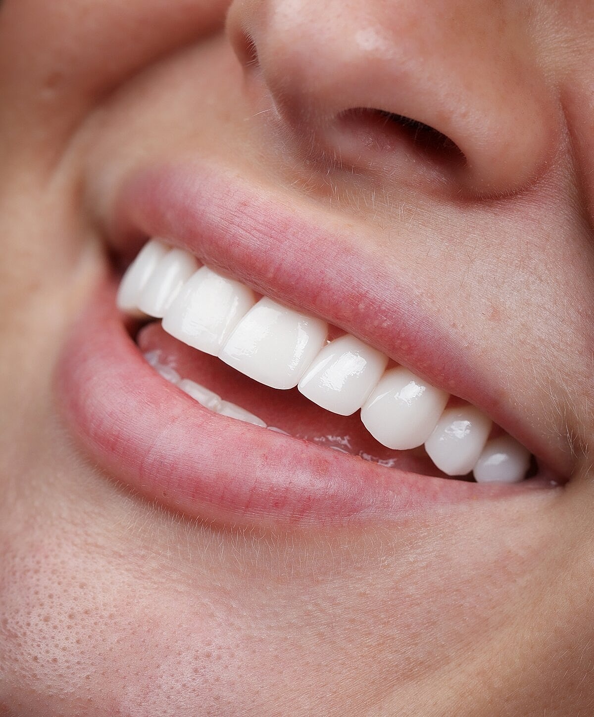 Close-up of a smiling person's mouth and teeth.