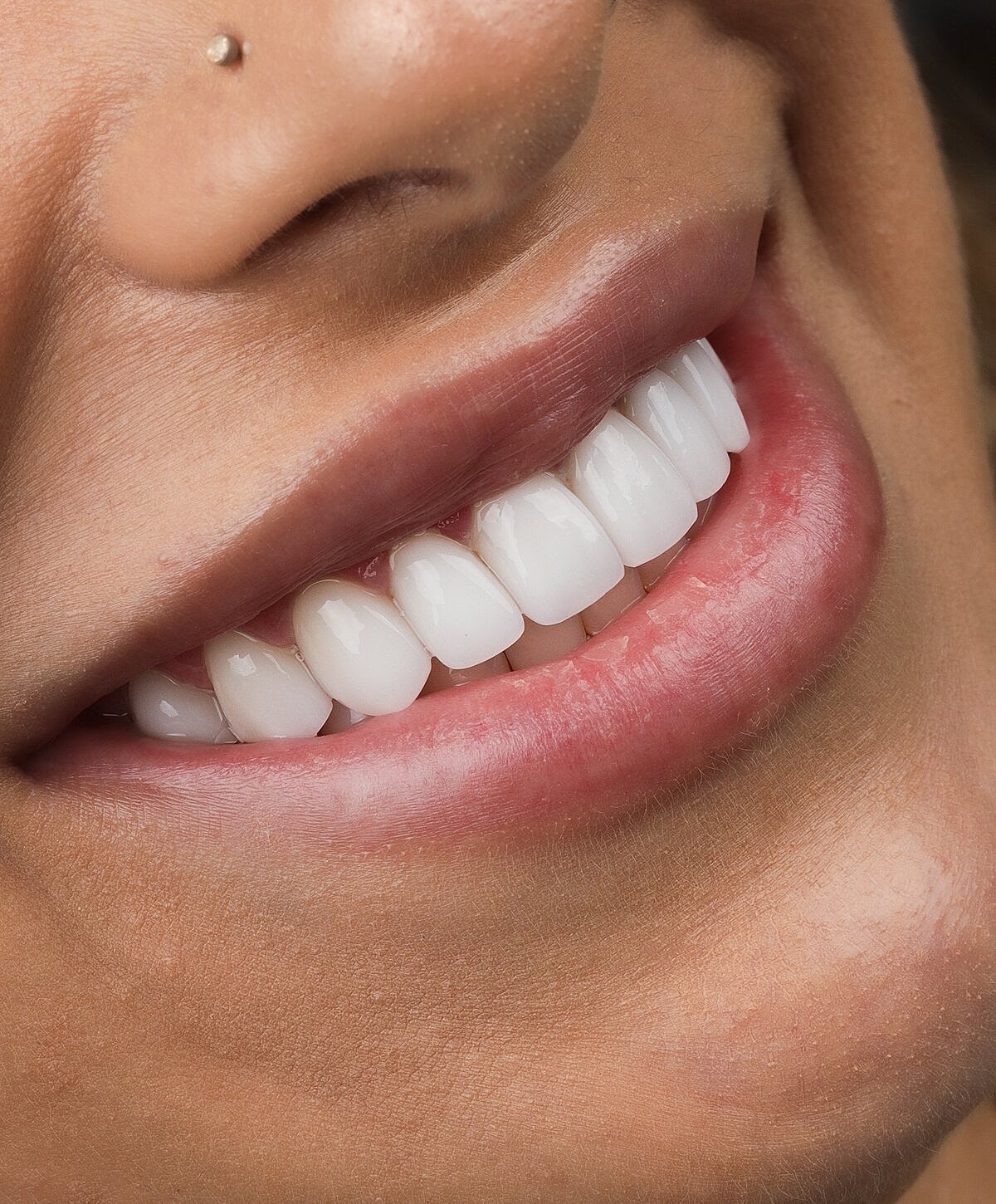 Close-up of a smiling mouth with white teeth.