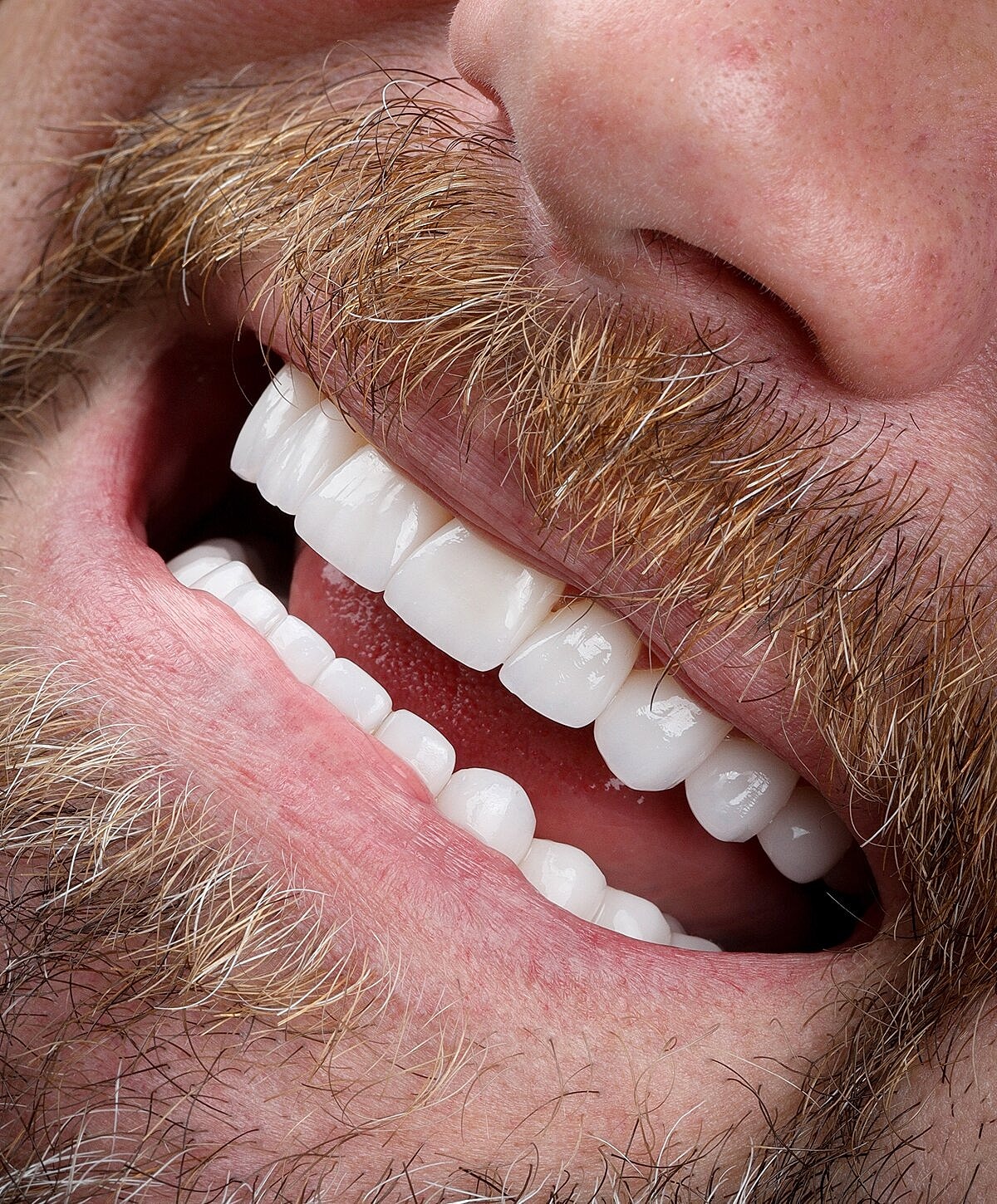 Close-up of a smiling mouth with teeth.