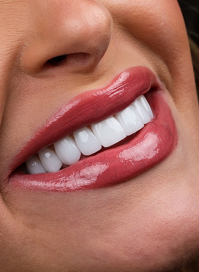 Close-up of bright smile with glossy lips.