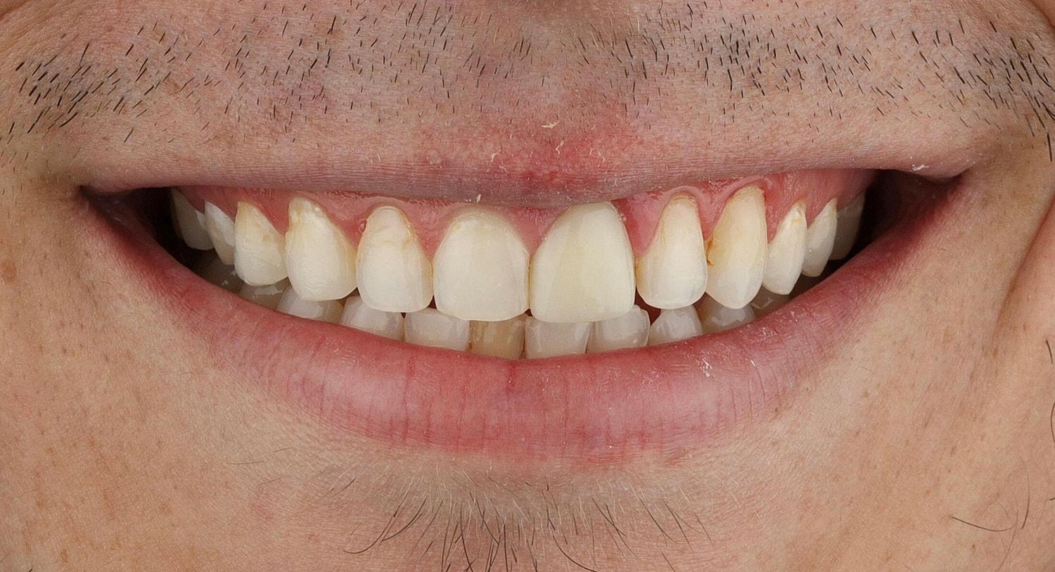 Patients Before & After
