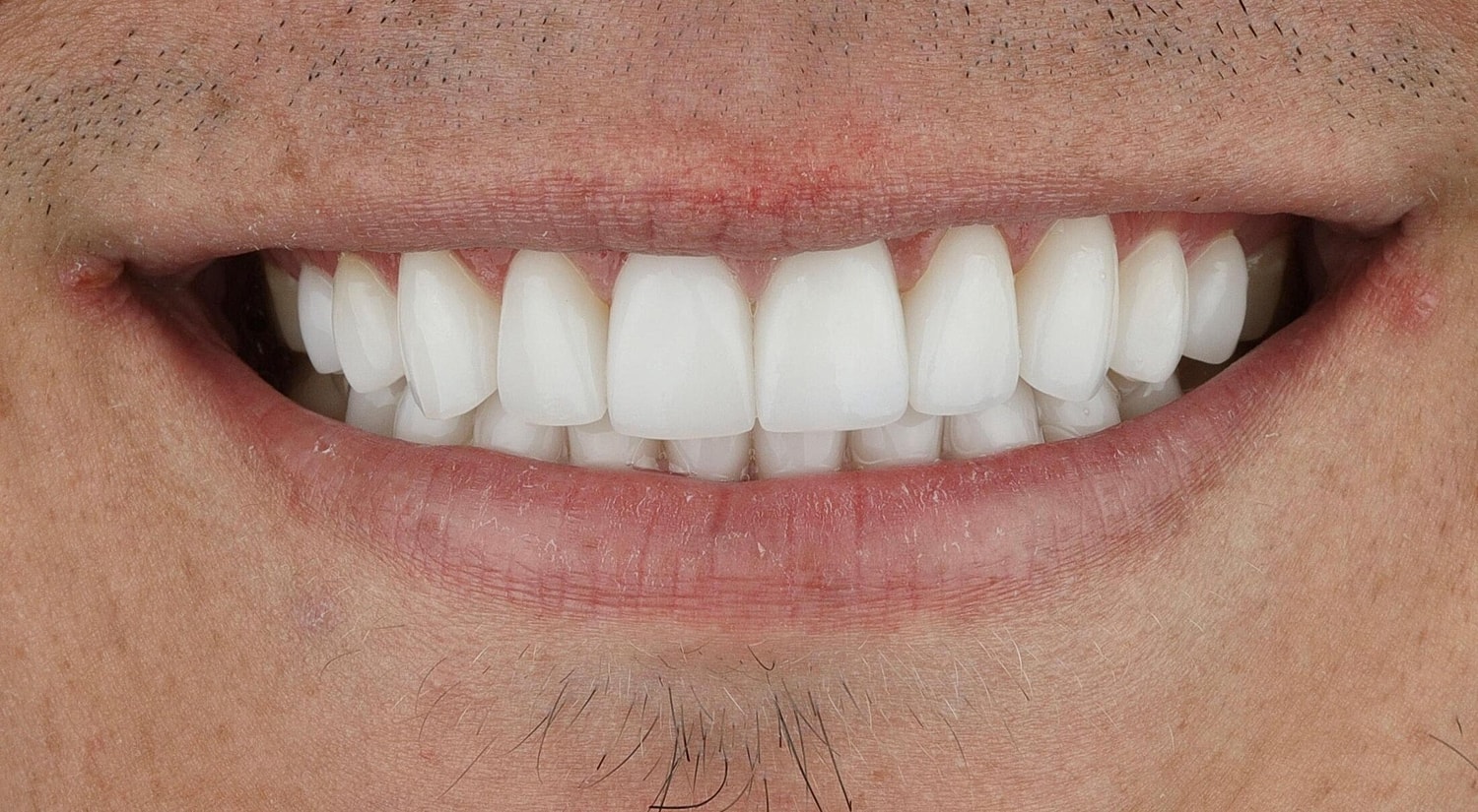 Patients Before & After