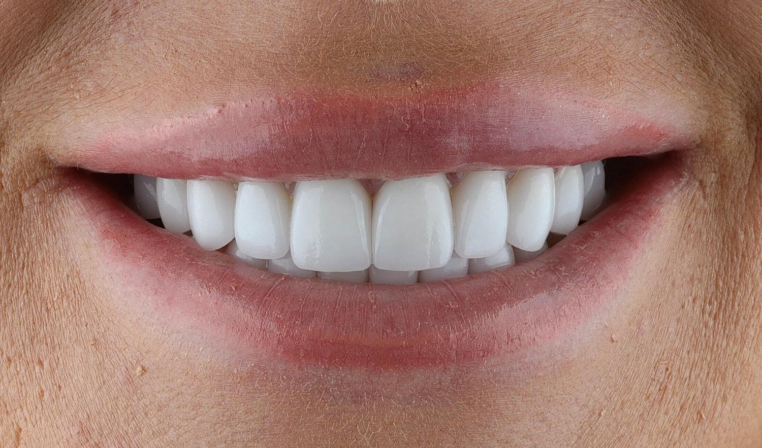 Patients Before & After