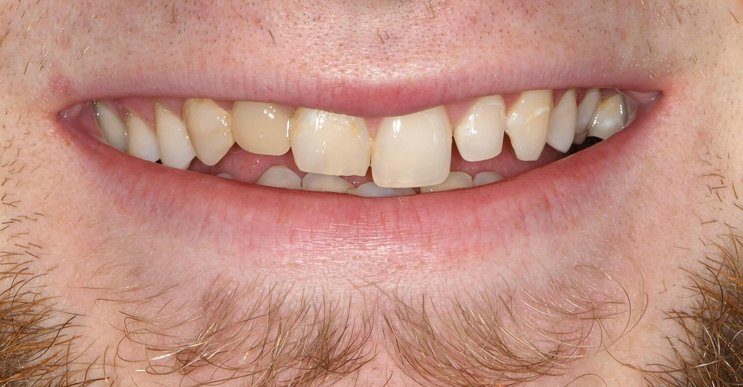 Patients Before & After