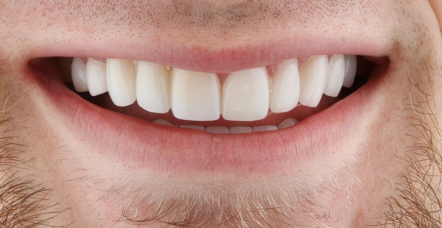 Patients Before & After