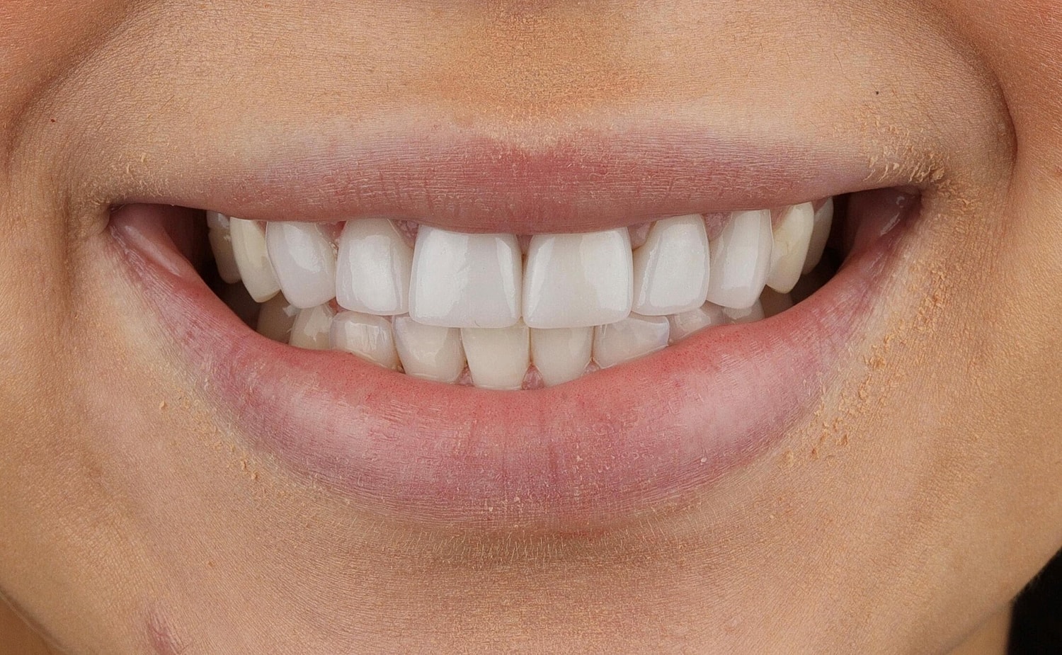 Patients Before & After