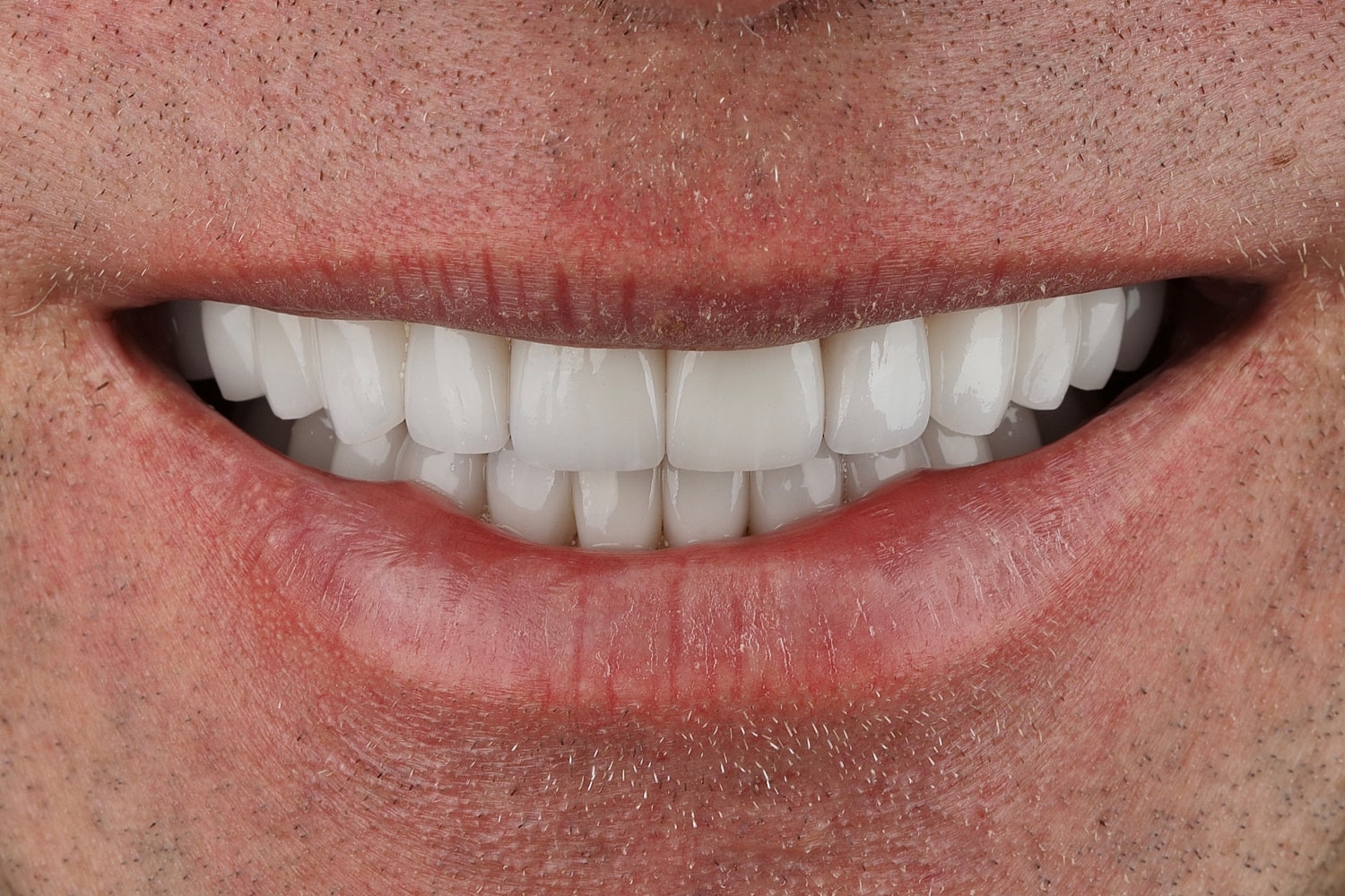 Close-up of a smiling mouth with white teeth.
