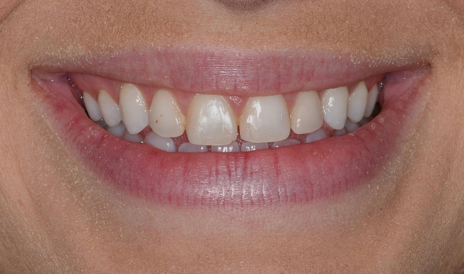 Patients Before & After