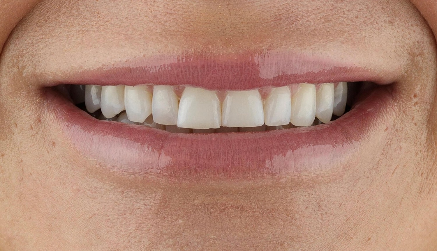 Patients Before & After