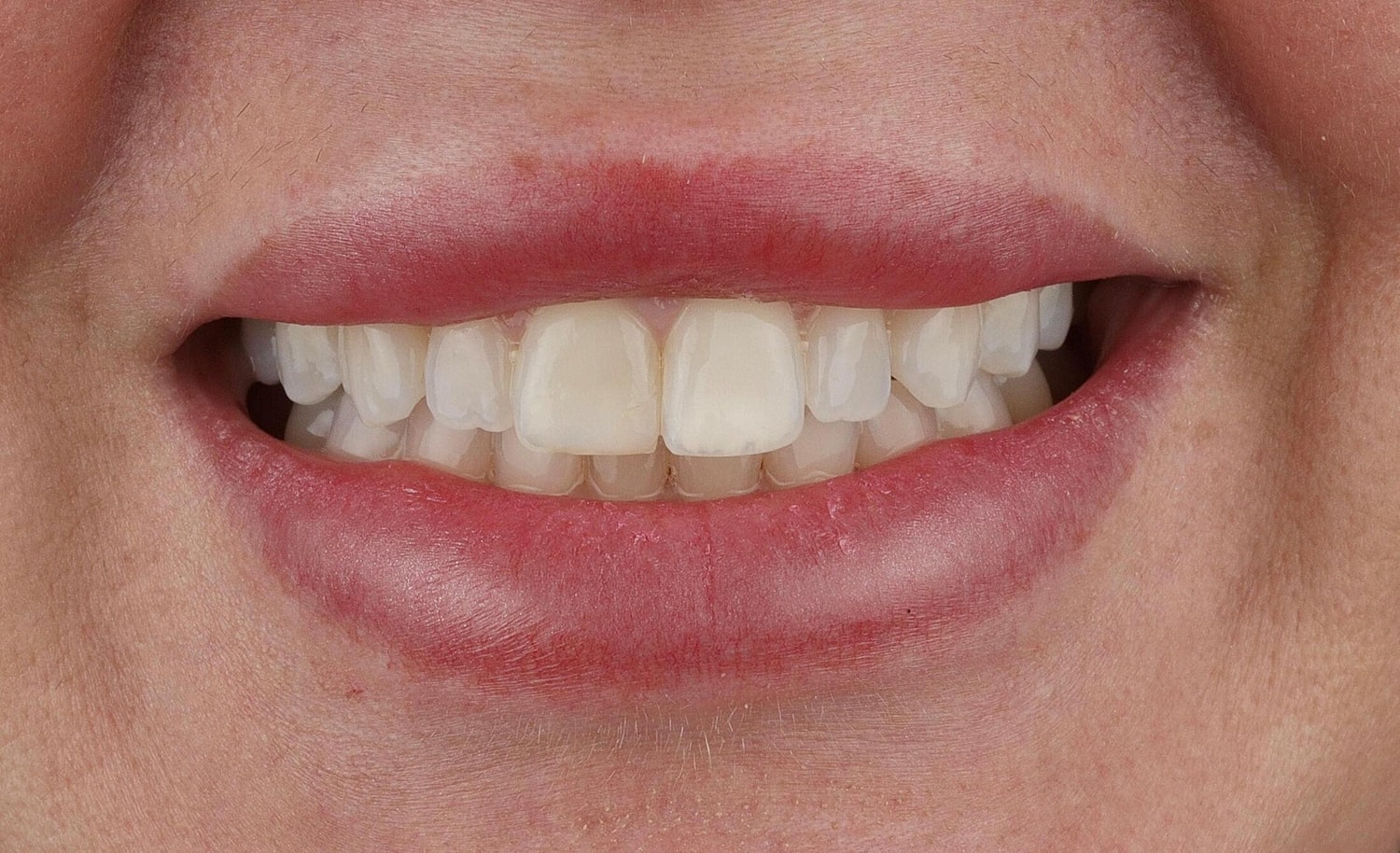 Patients Before & After