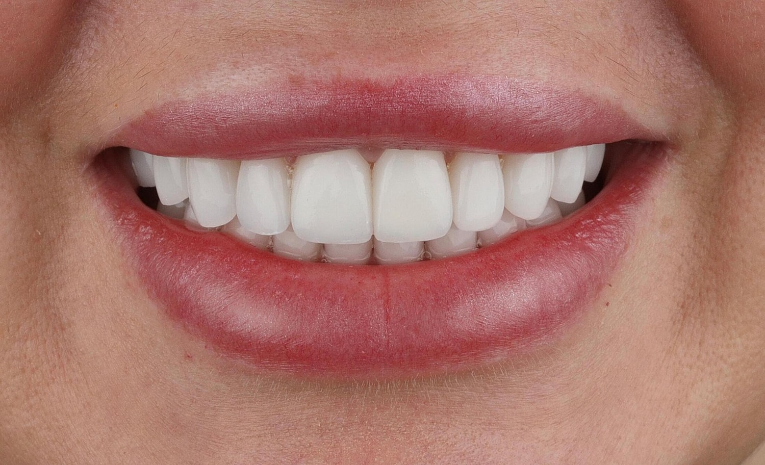 Patients Before & After