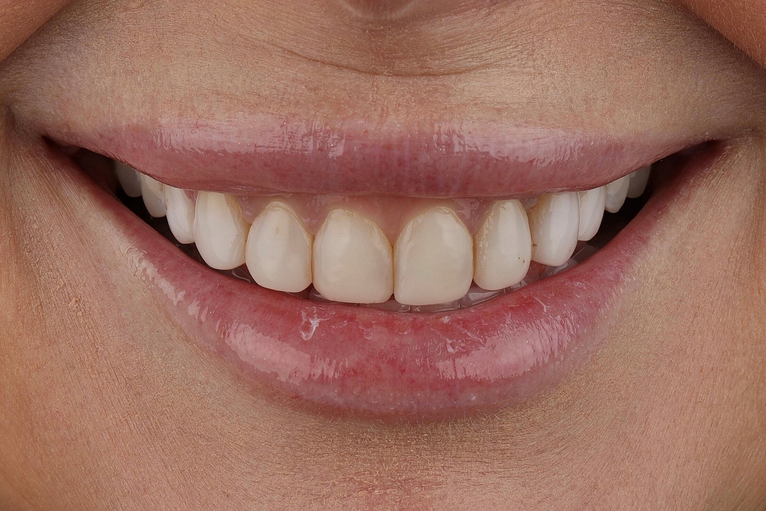 Patients Before & After