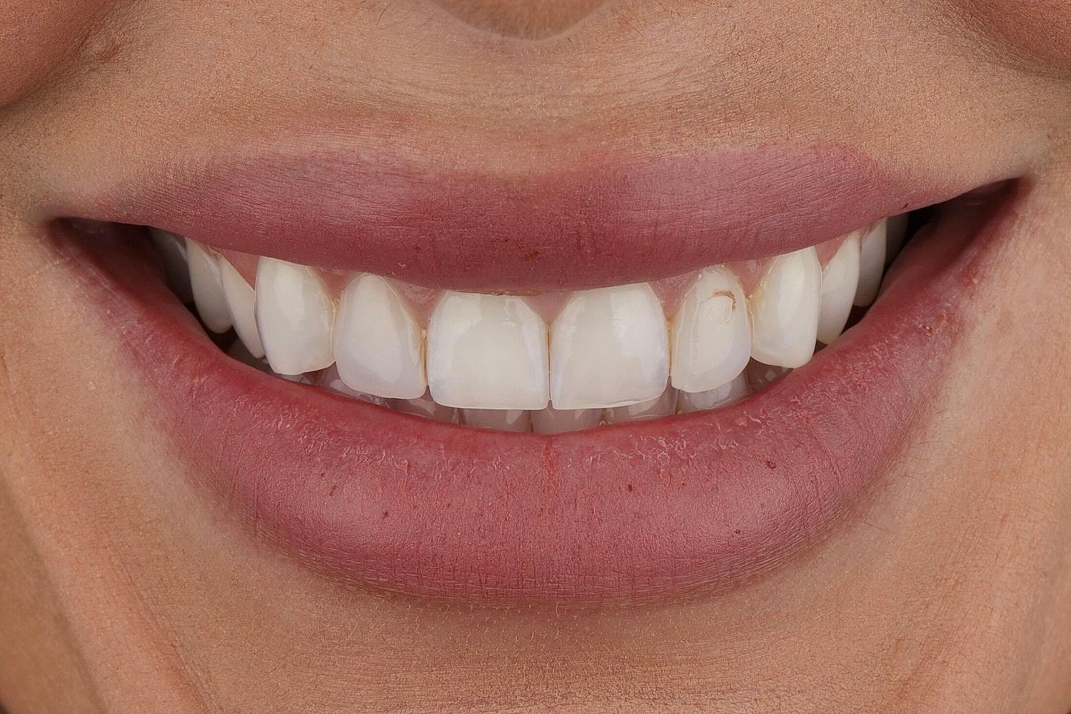 Patients Before & After