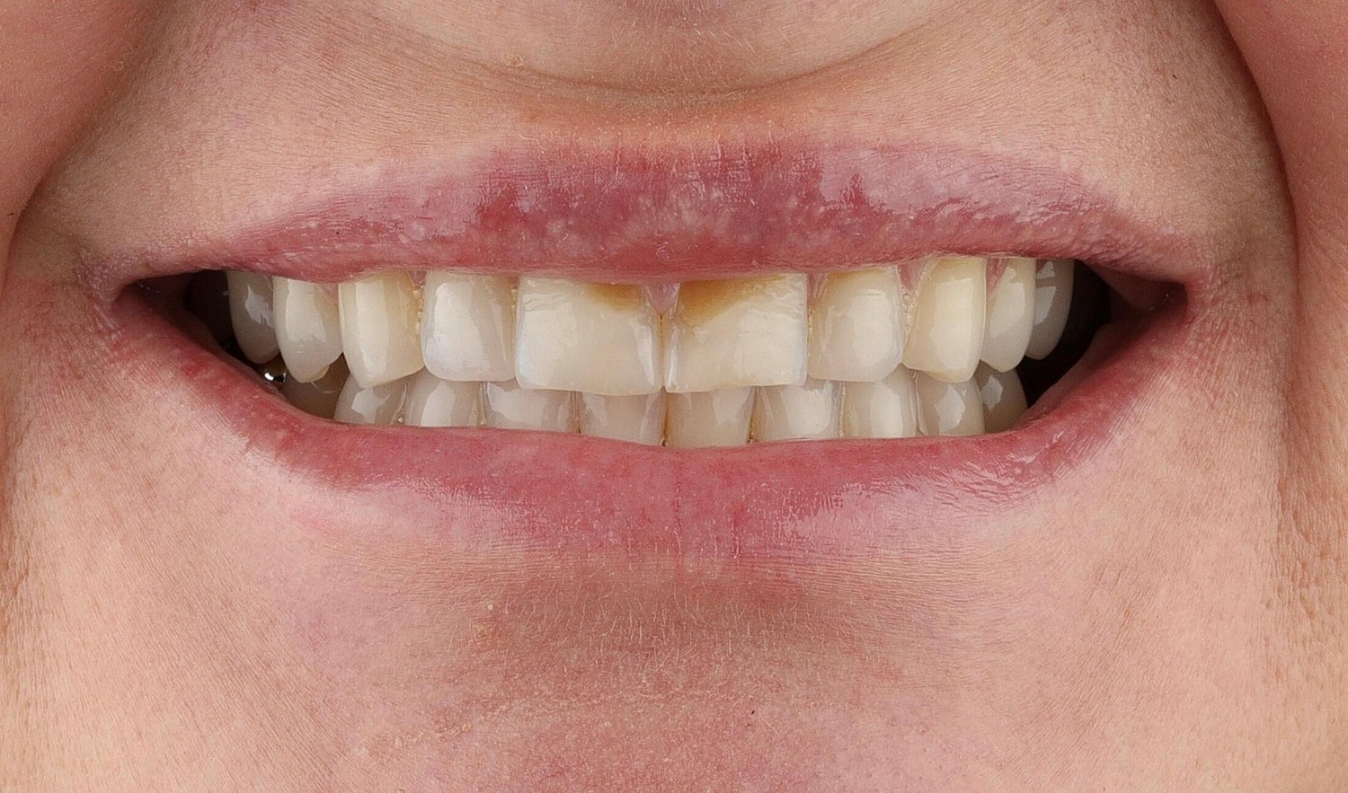 Patients Before & After