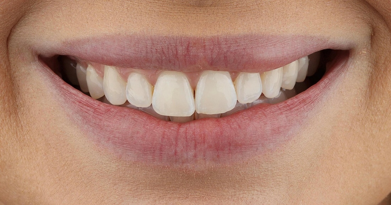 Patients Before & After