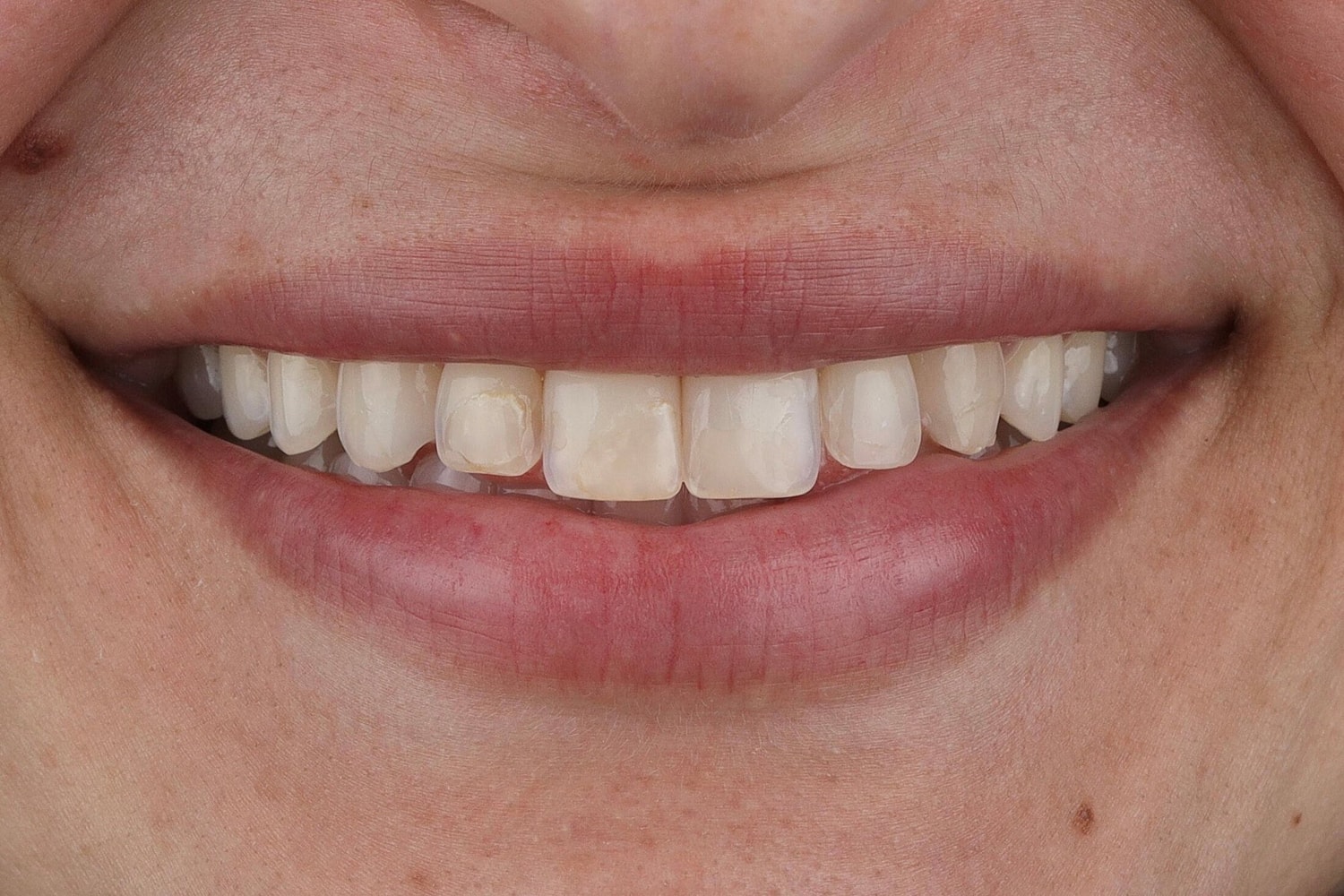 Patients Before & After
