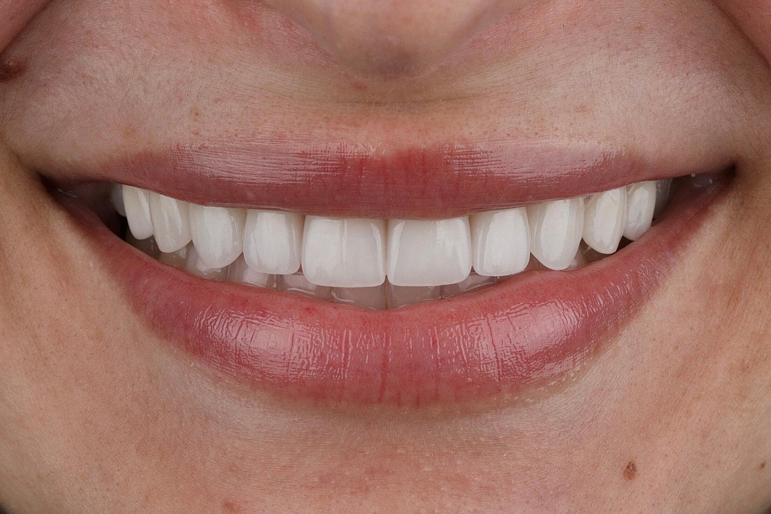 Patients Before & After