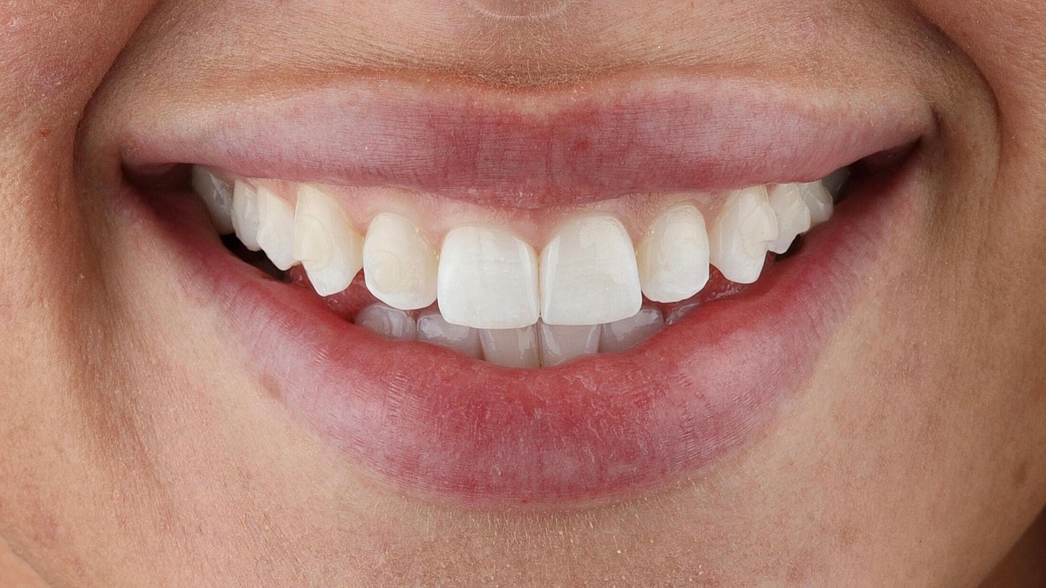 Patients Before & After