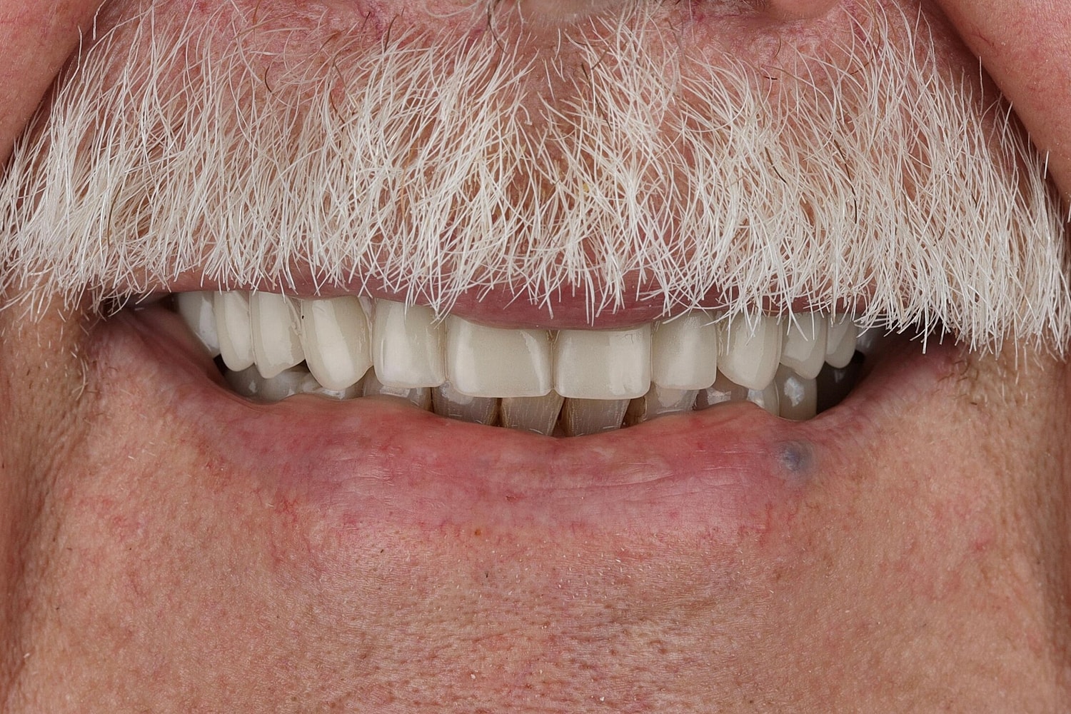 Patients Before & After