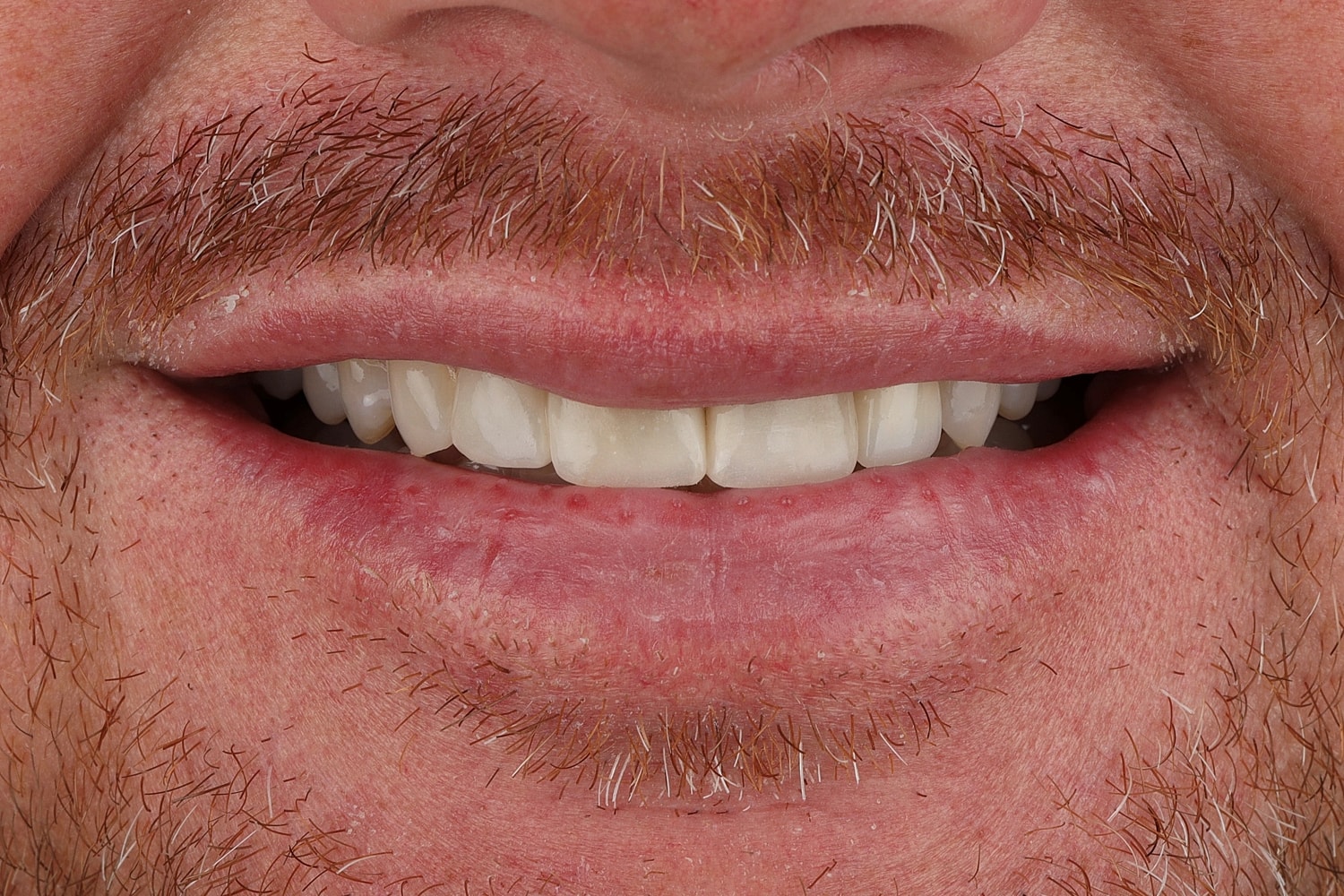 Close-up of smiling mouth and facial hair.
