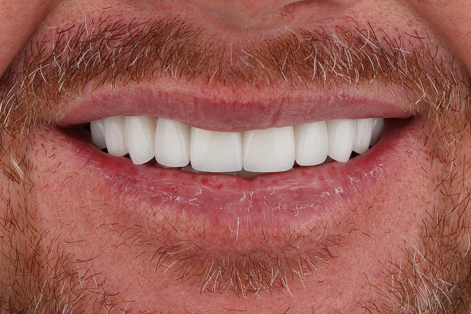 Close-up of a smiling man's mouth.