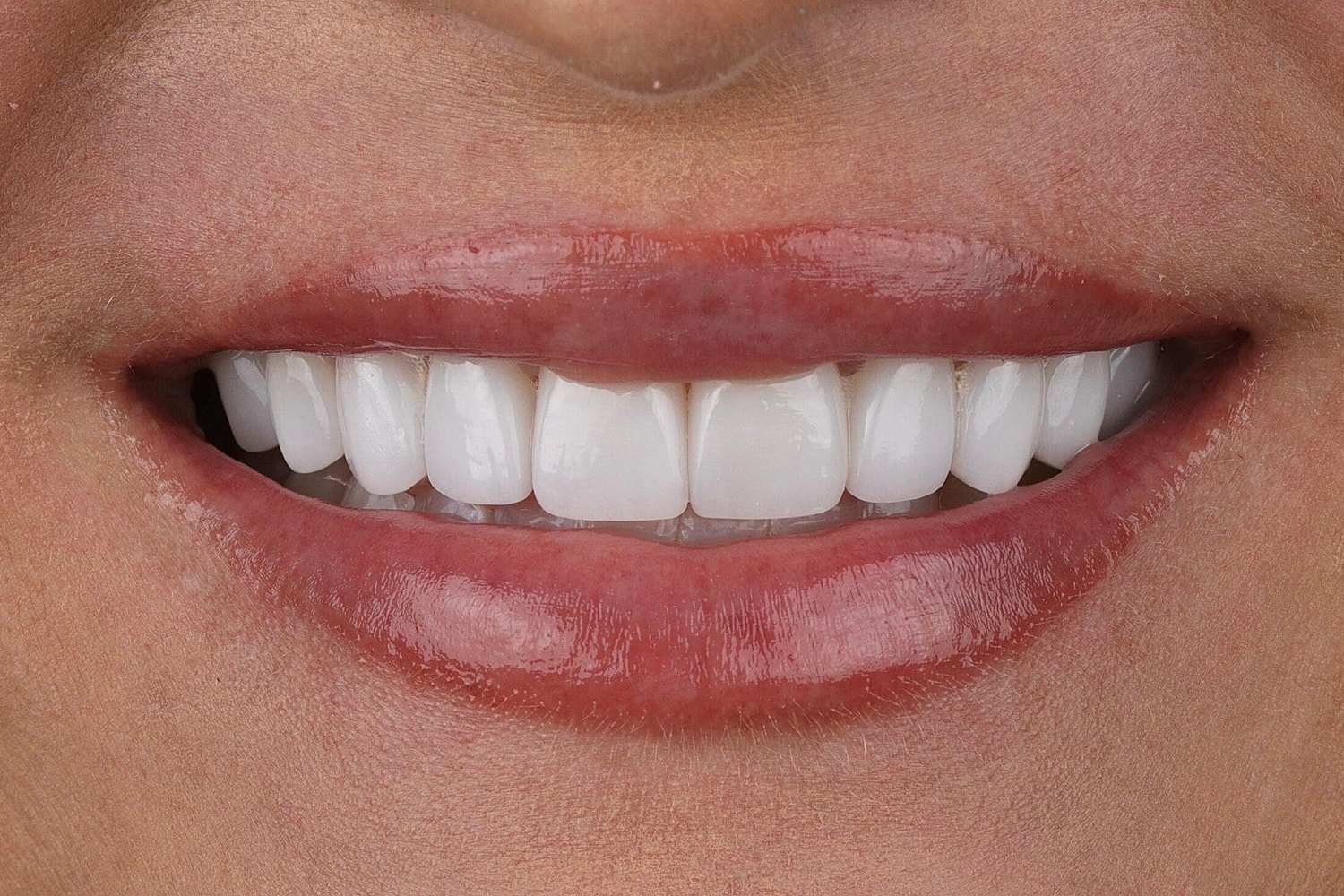 Patients Before & After