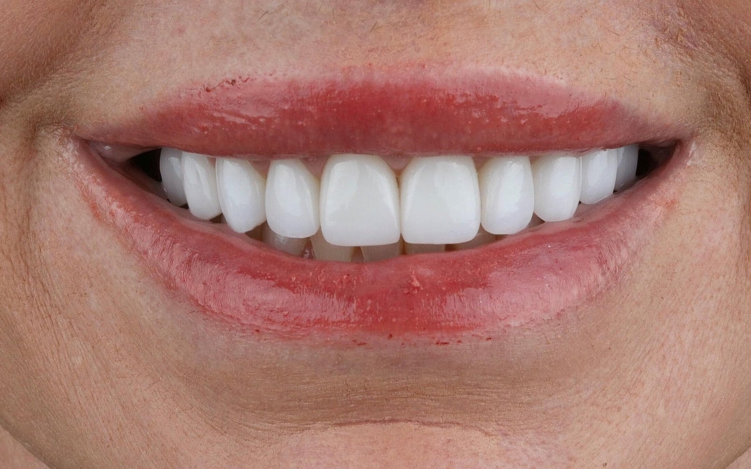 Patients Before & After
