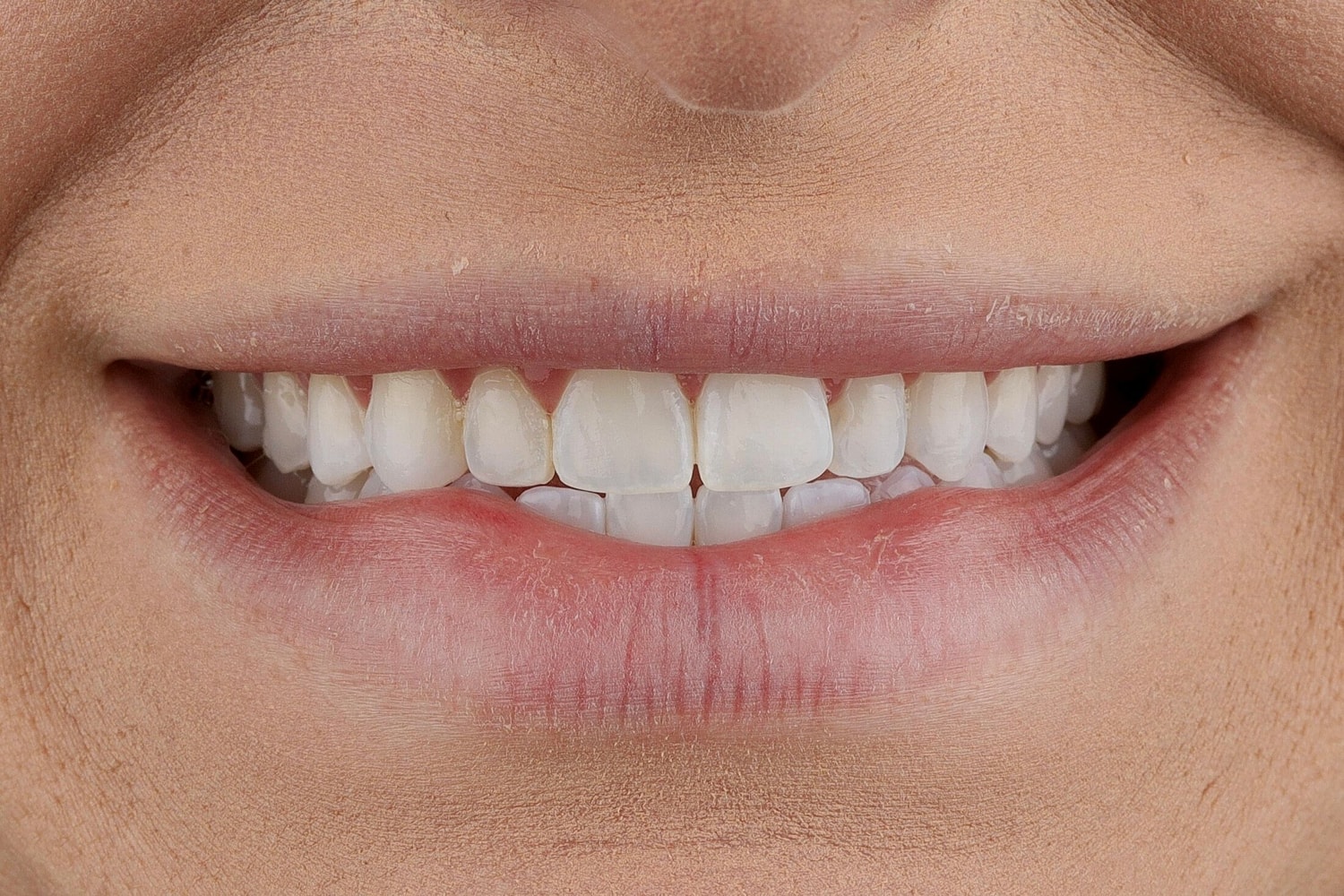 Patients Before & After