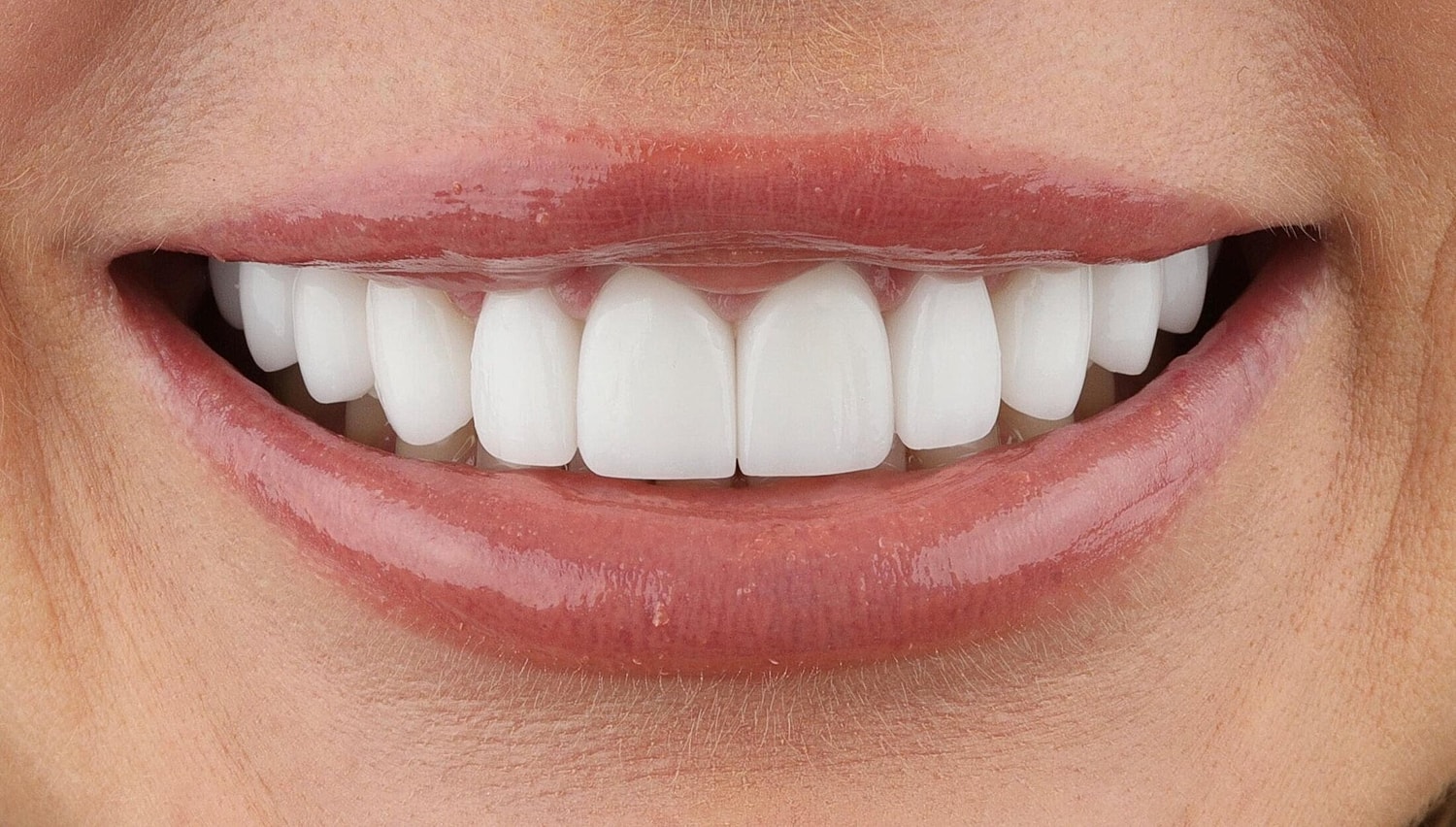 Close-up of a bright, smiling mouth.