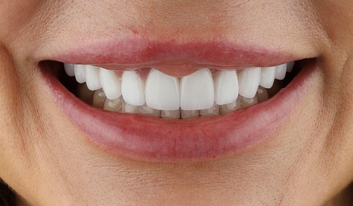 Close-up of a bright, healthy smile.