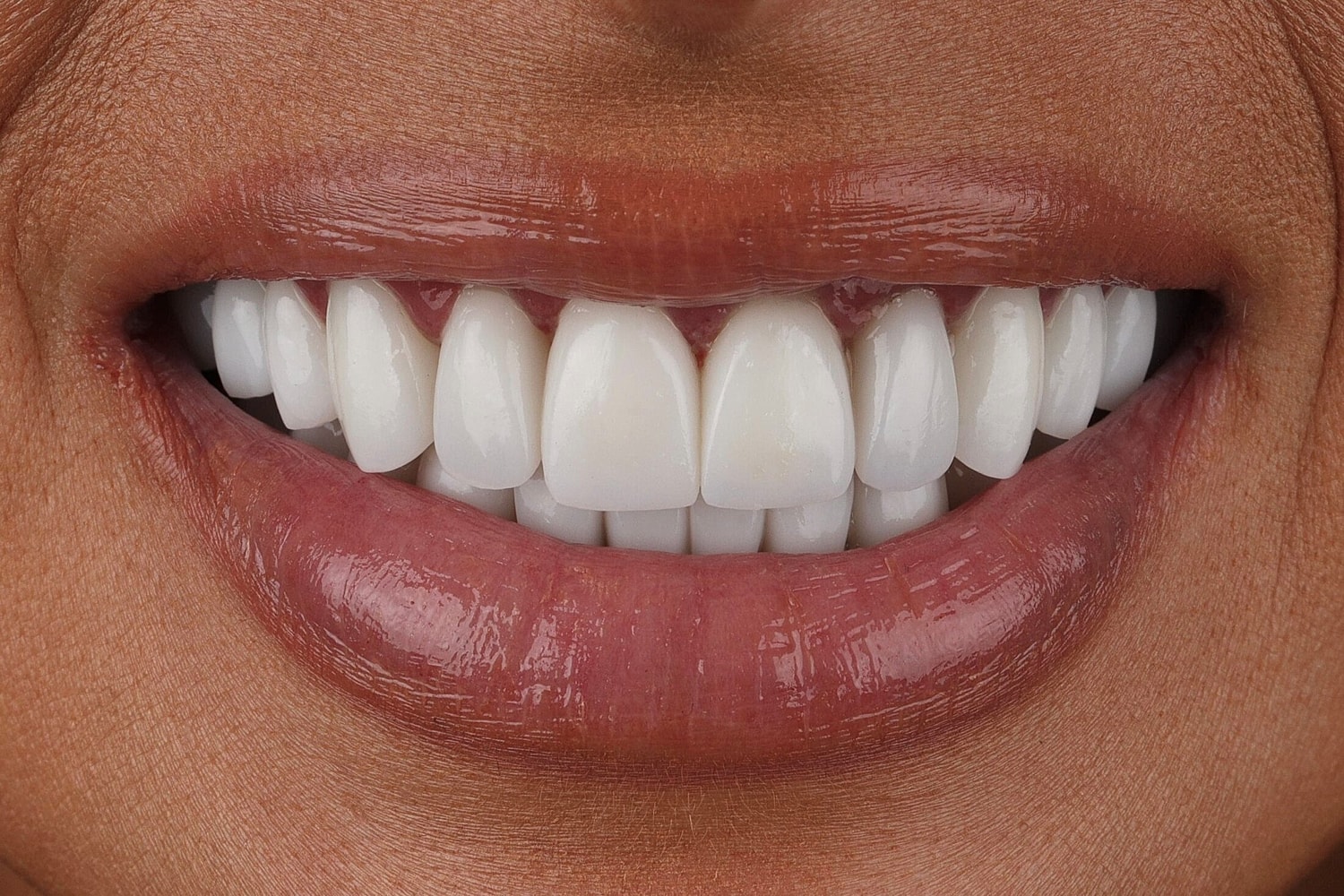 Patients Before & After
