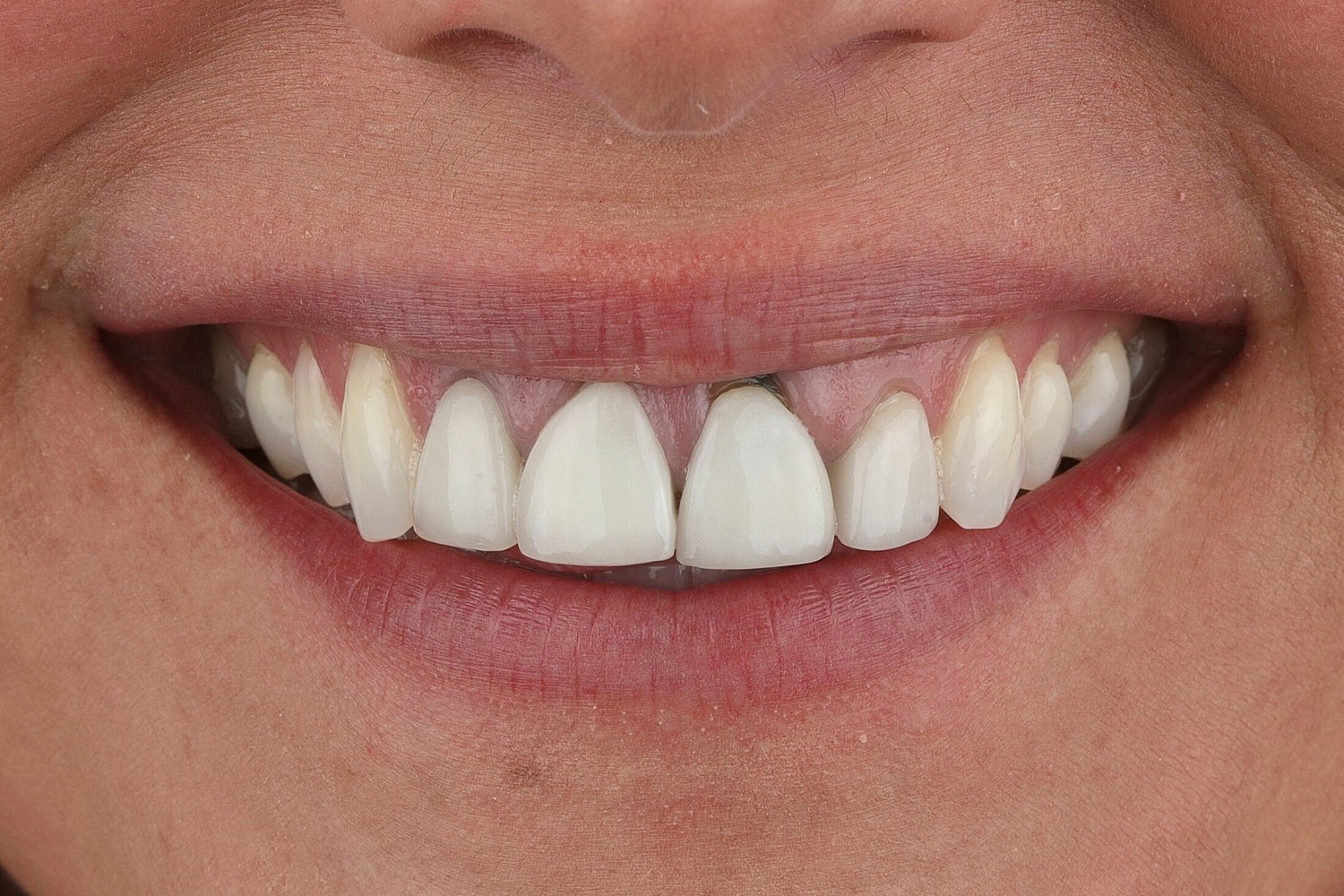Patients Before & After