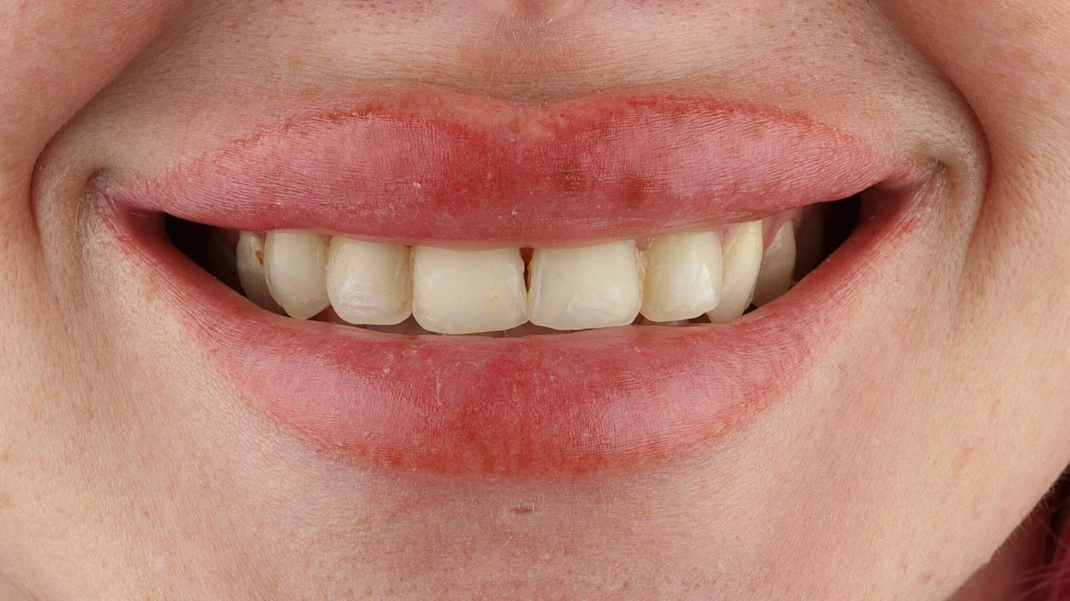 Patients Before & After