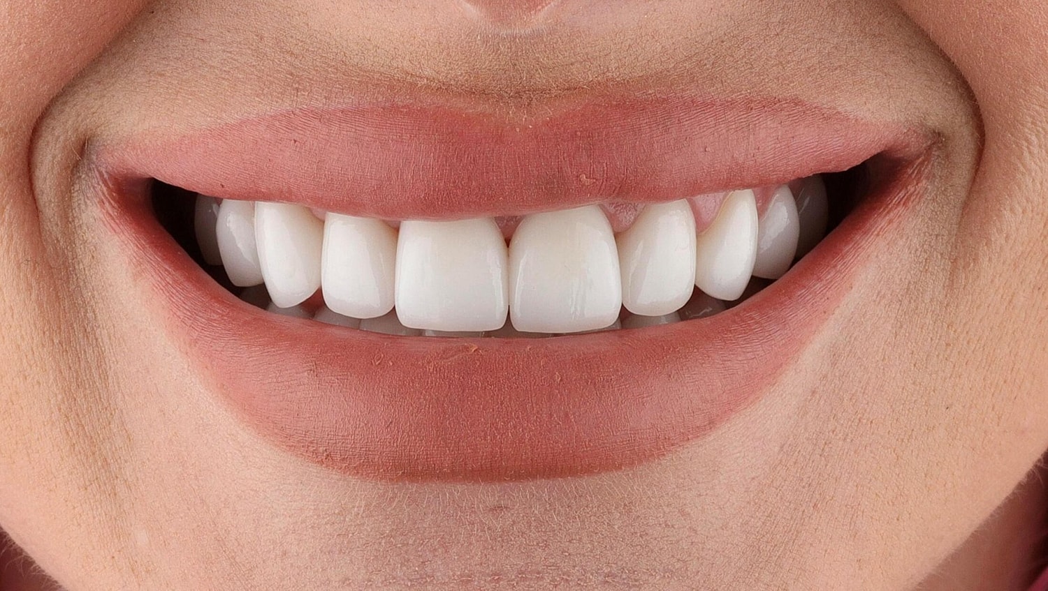 Patients Before & After