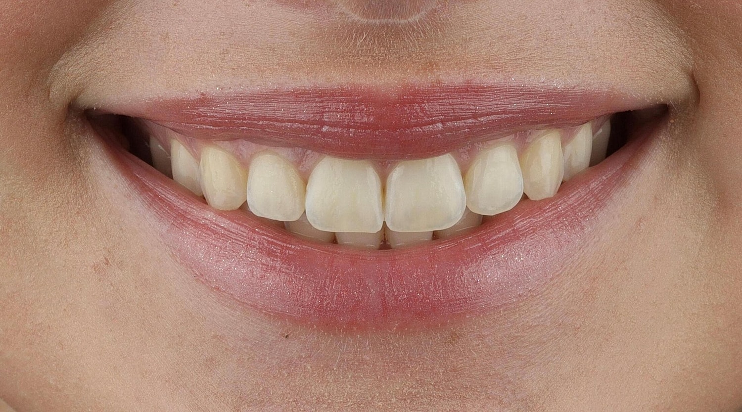 Patients Before & After