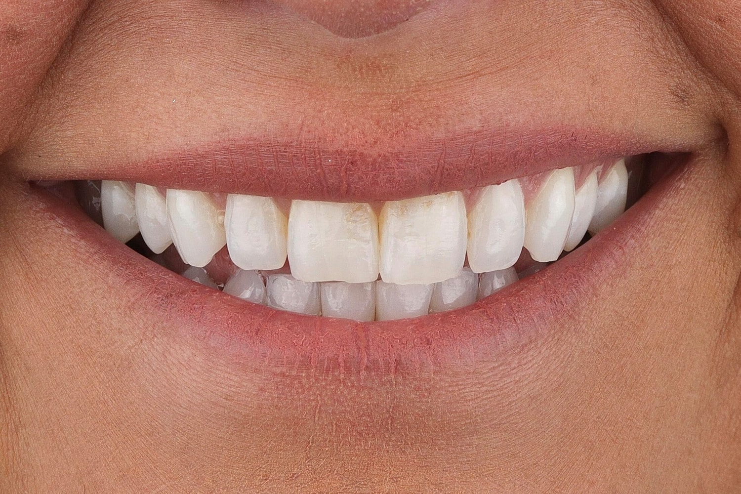 Patients Before & After