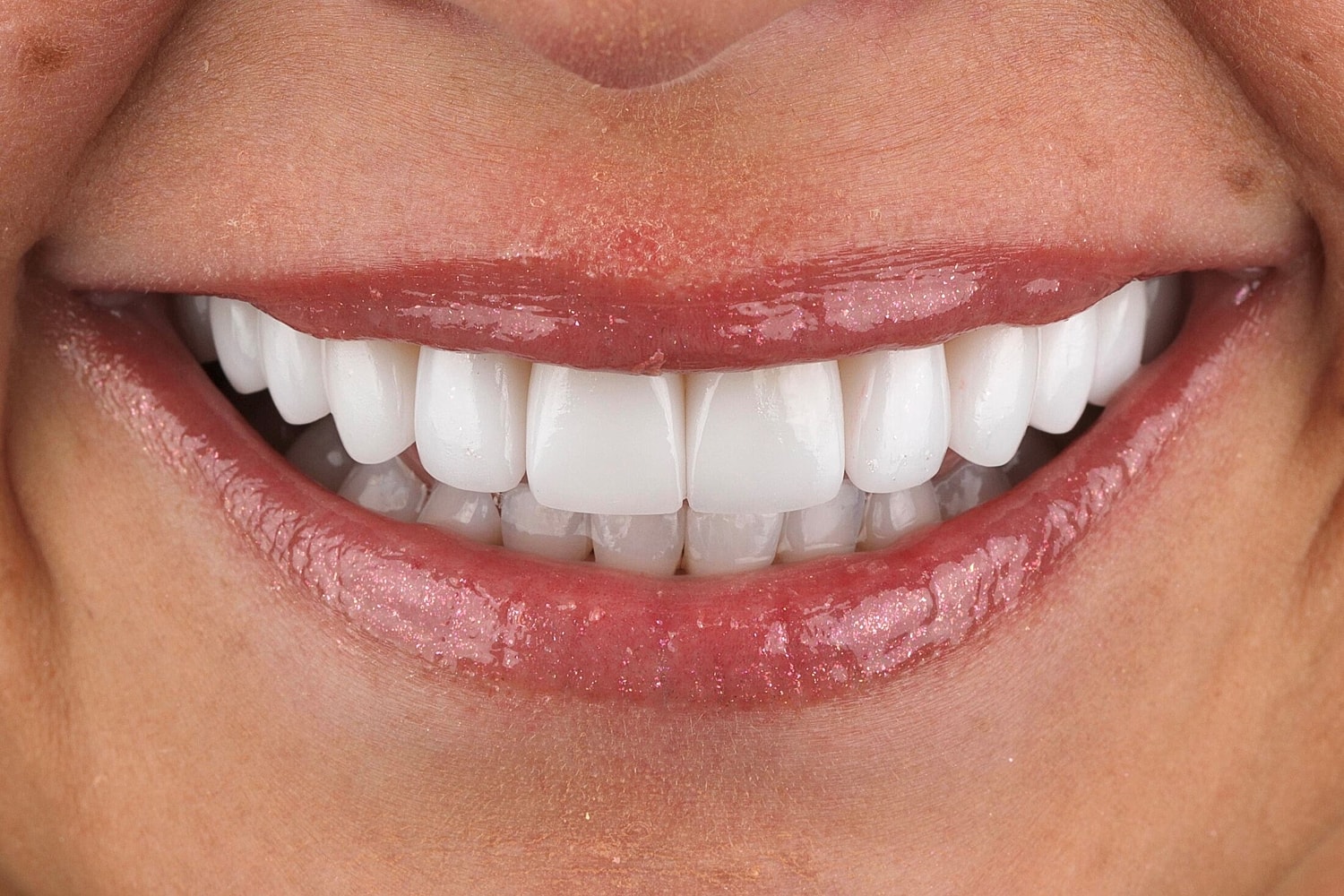 Patients Before & After