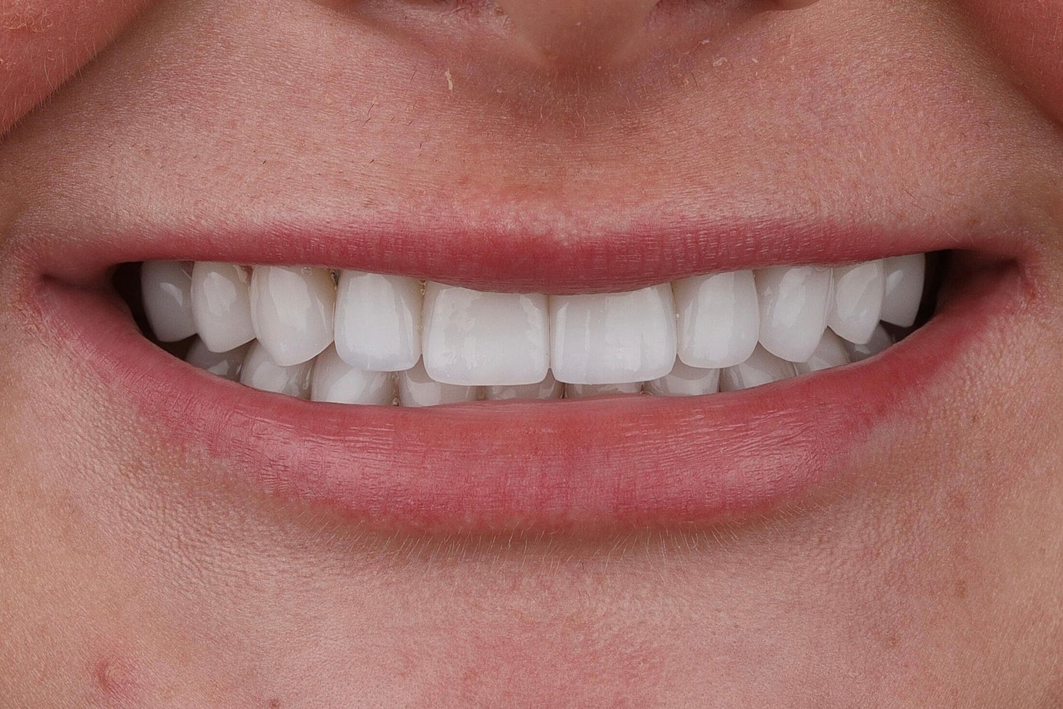 Patients Before & After