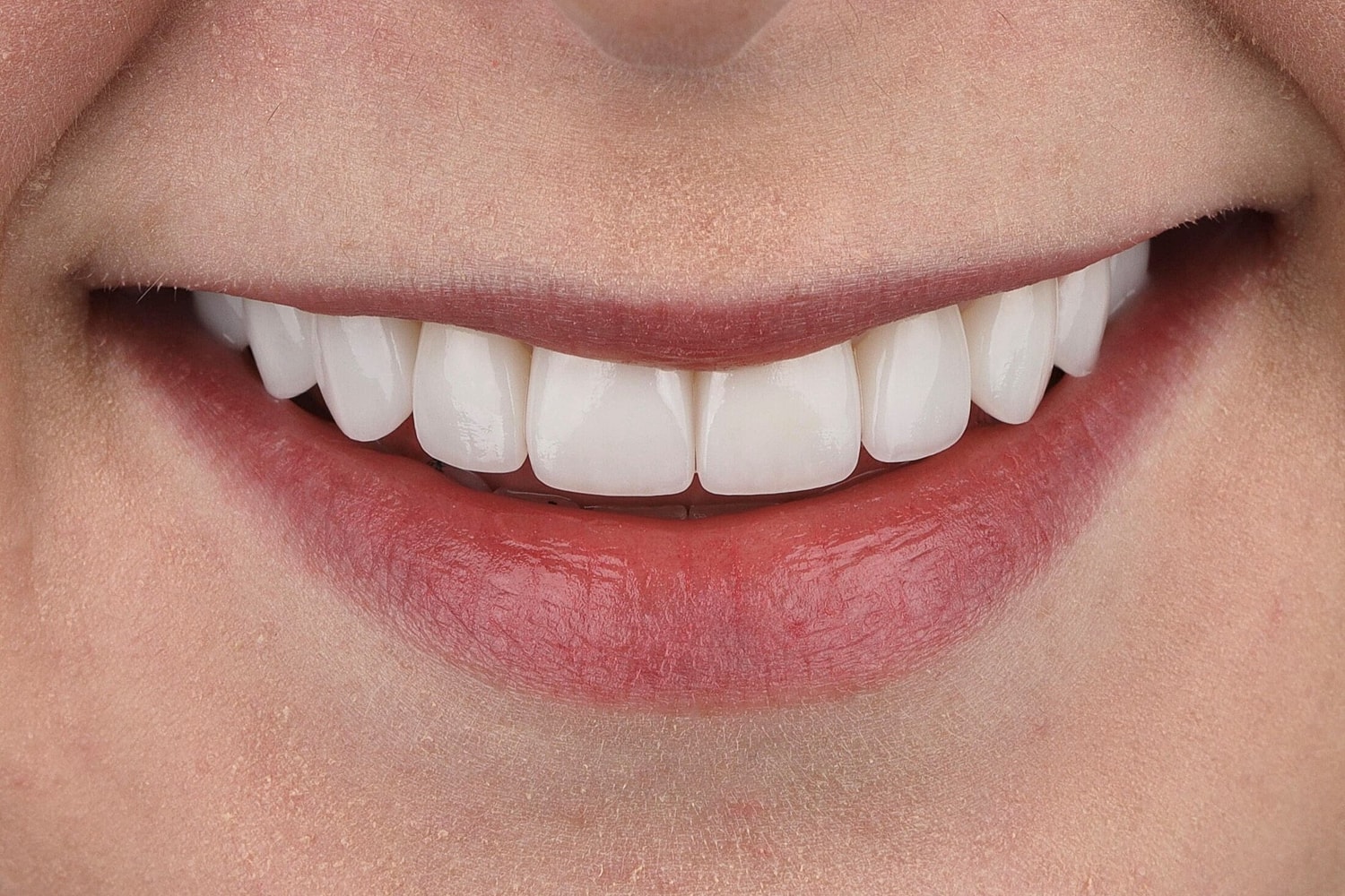 Patients Before & After