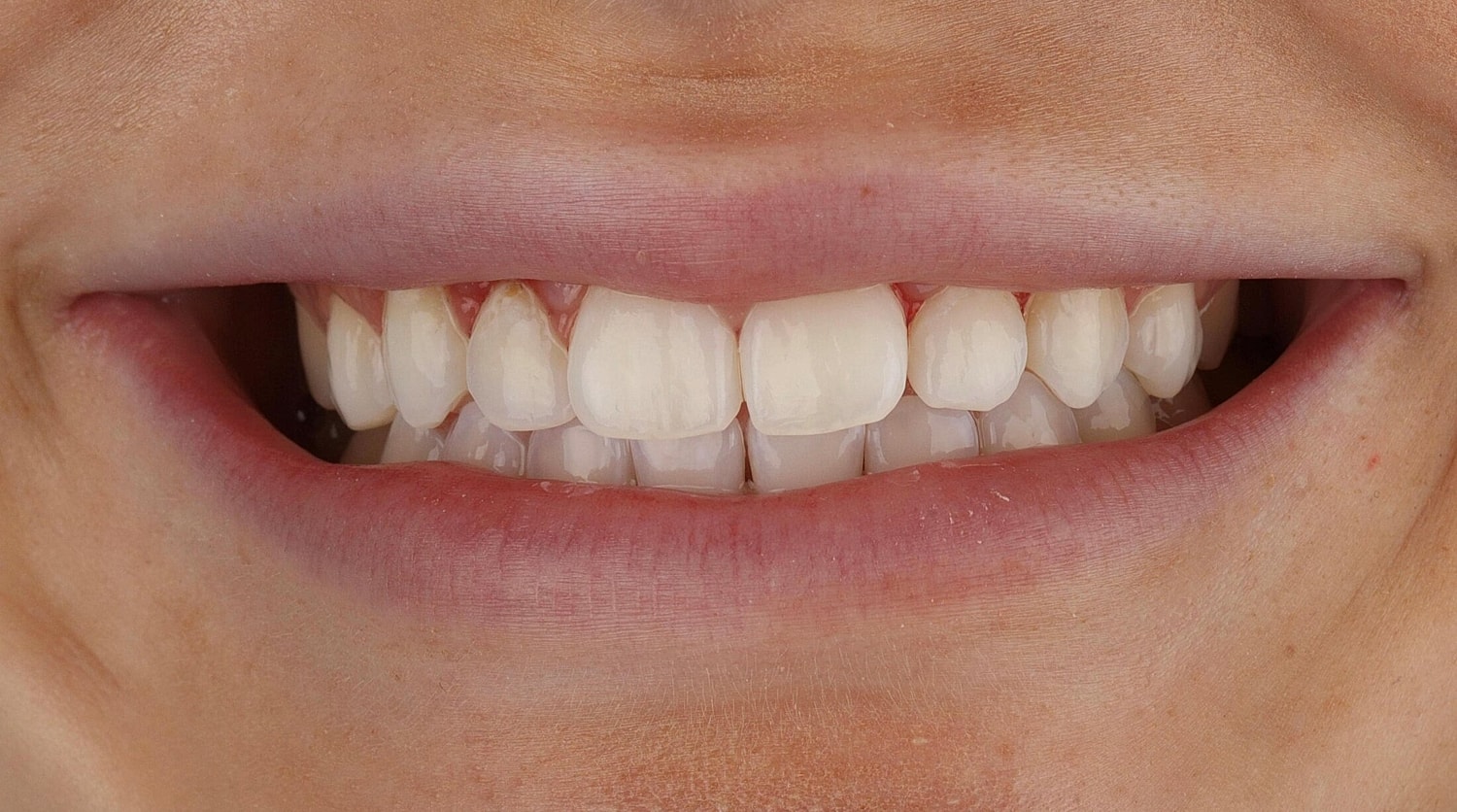 Patients Before & After