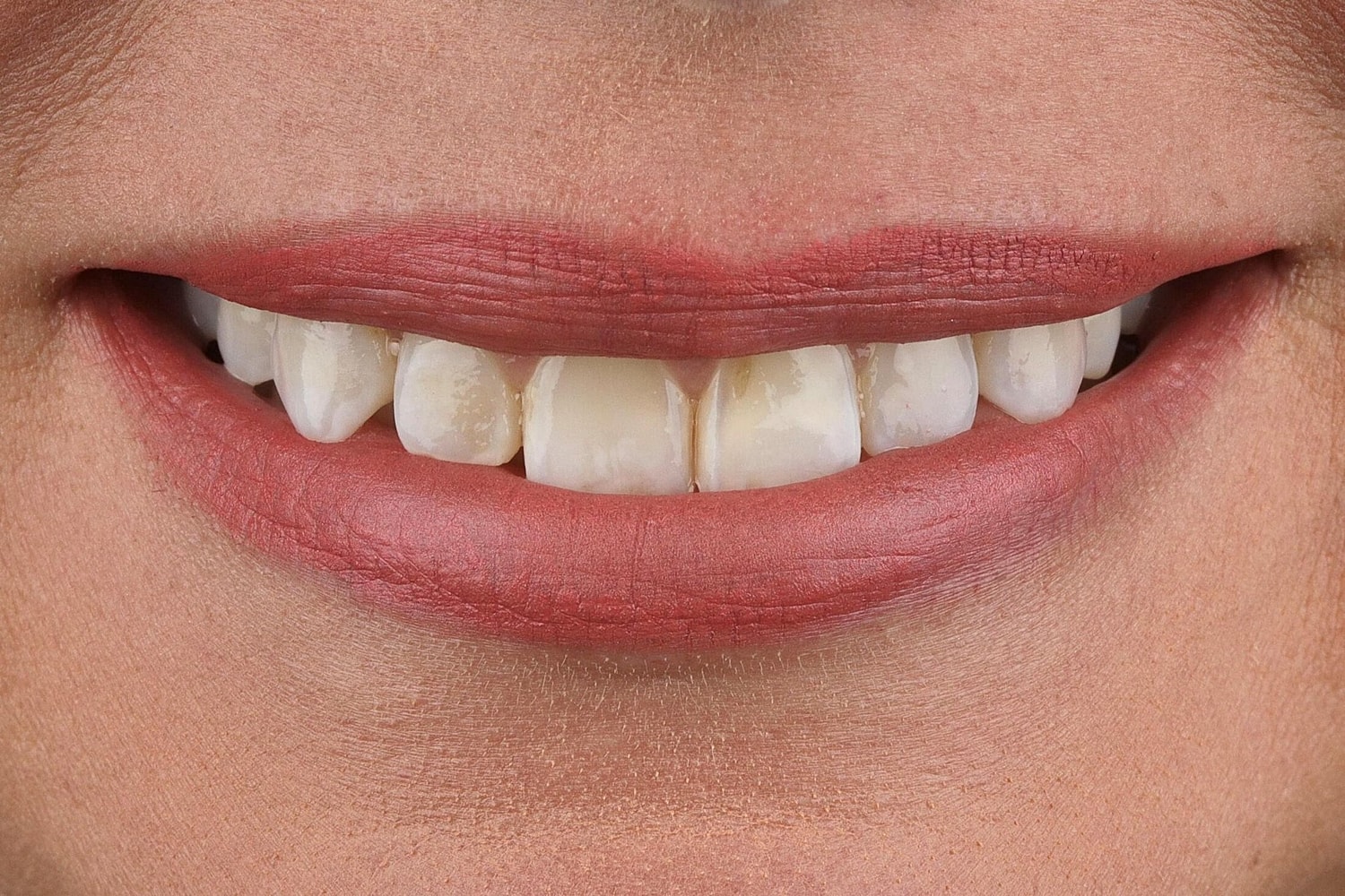 Patients Before & After