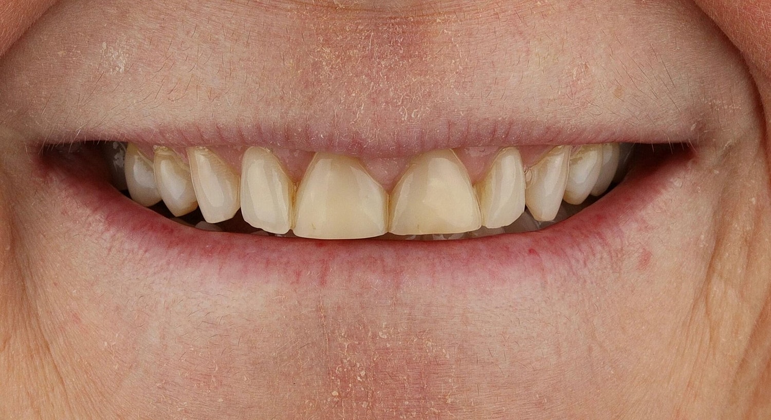 Patients Before & After