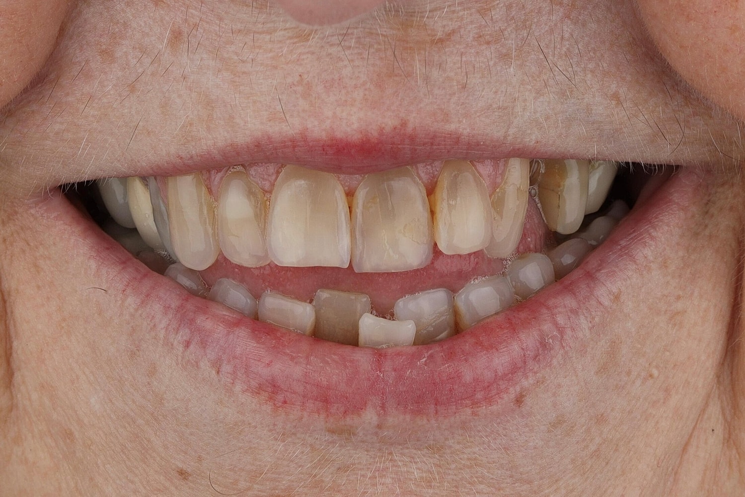 Patients Before & After