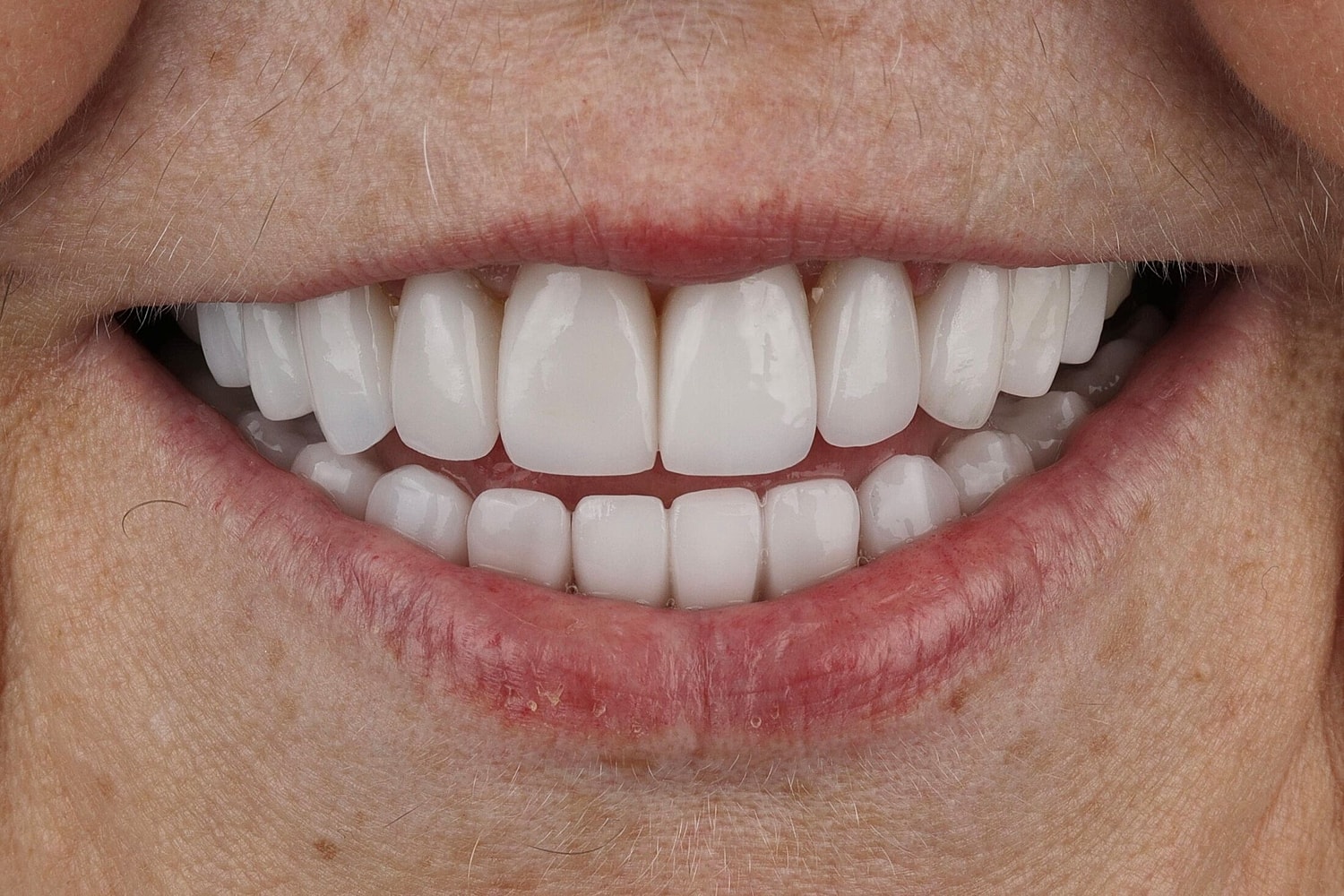 Patients Before & After