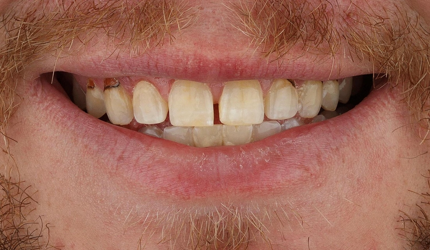Patients Before & After