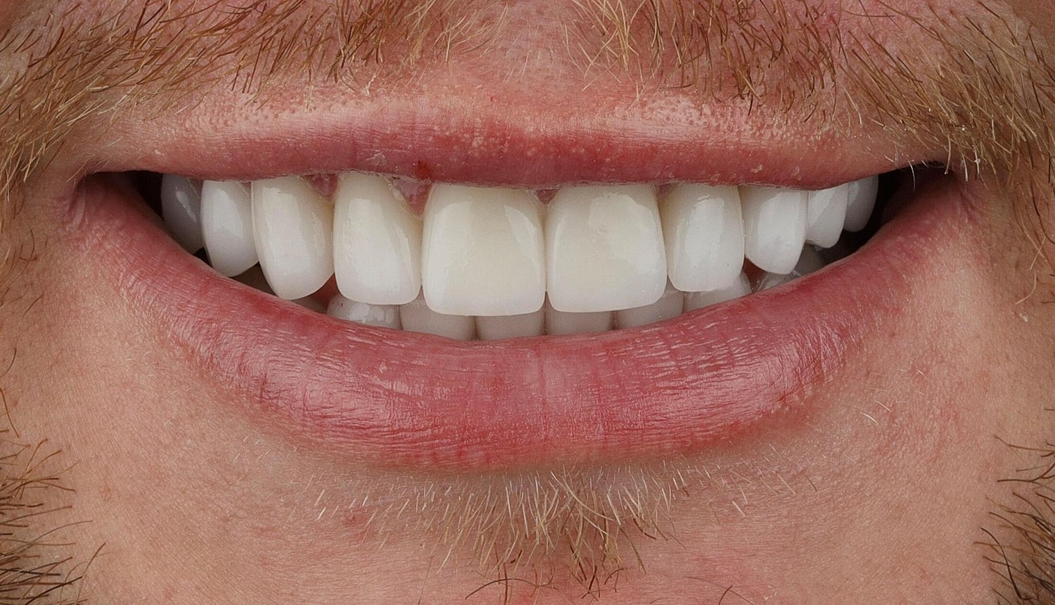Patients Before & After